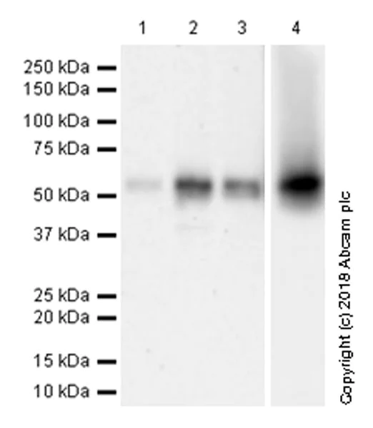 Western blot - Anti-PCSK9 antibody [EPR17827-117] (AB185194)