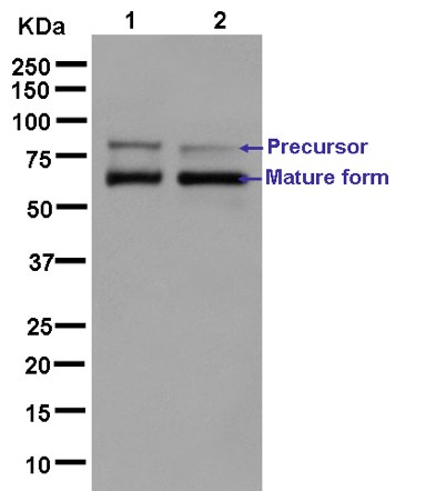 Western blot - Anti-PCSK9 antibody [EPR7627(2)] (AB181142)