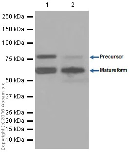 Western blot - Anti-PCSK9 antibody [EPR7627(2)] (AB181142)