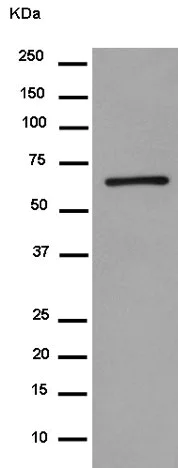 Western blot - Anti-PCSK9 antibody [EPR7627(2)] (AB181142)