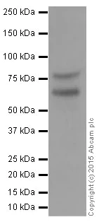 Western blot - Anti-PCSK9 antibody [EPR7627(2)] (AB181142)