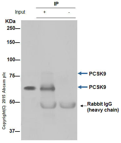 Immunoprecipitation - Anti-PCSK9 antibody [EPR7627(2)] - BSA and Azide free (AB238995)