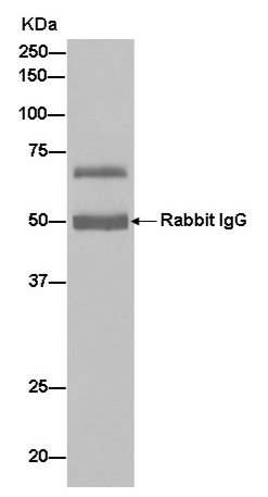 Immunoprecipitation - Anti-PCSK9 antibody [EPR7627(2)] - BSA and Azide free (AB238995)