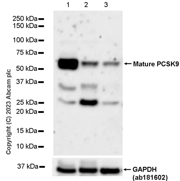 Western blot - Anti-PCSK9 antibody [RM1106] (AB315480)