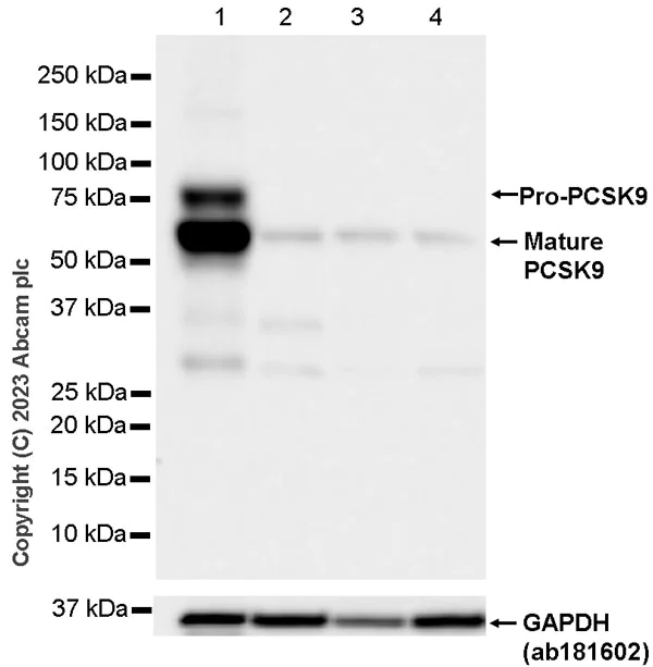 Western blot - Anti-PCSK9 antibody [RM1106] - BSA and Azide free (AB315481)