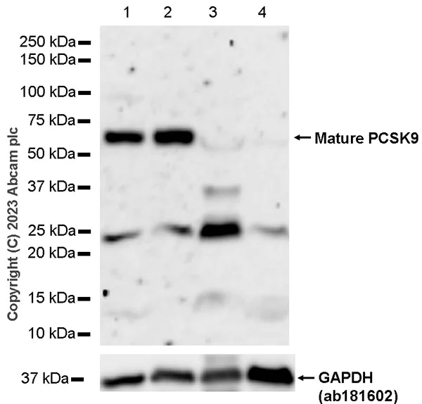 Western blot - Anti-PCSK9 antibody [RM1106] - BSA and Azide free (AB315481)