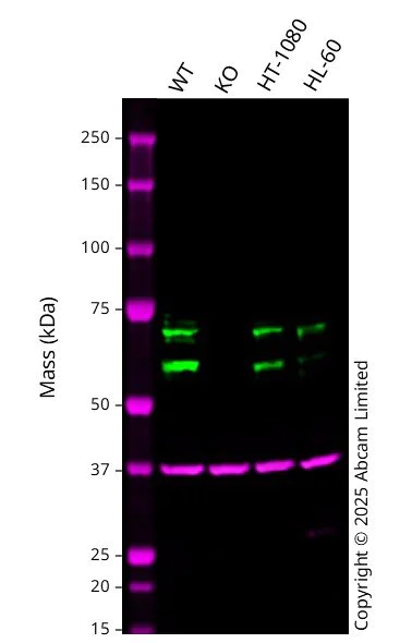 Western blot - Anti-PCTAIRE1 antibody [EPR13210] (AB181208)