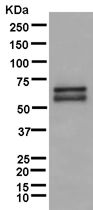 Western blot - Anti-PCTAIRE1 antibody [EPR13210] (AB181208)