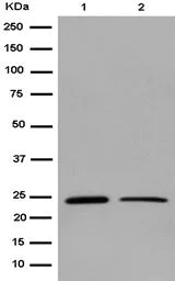 Western blot - Anti-PCTP antibody [EPR15390] (AB184944)