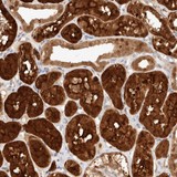 Immunohistochemistry (Formalin/PFA-fixed paraffin-embedded sections) - Anti-PCTP-L antibody (AB121876)