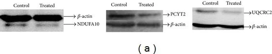 Western blot - Anti-PCYT2 antibody (AB126142)
