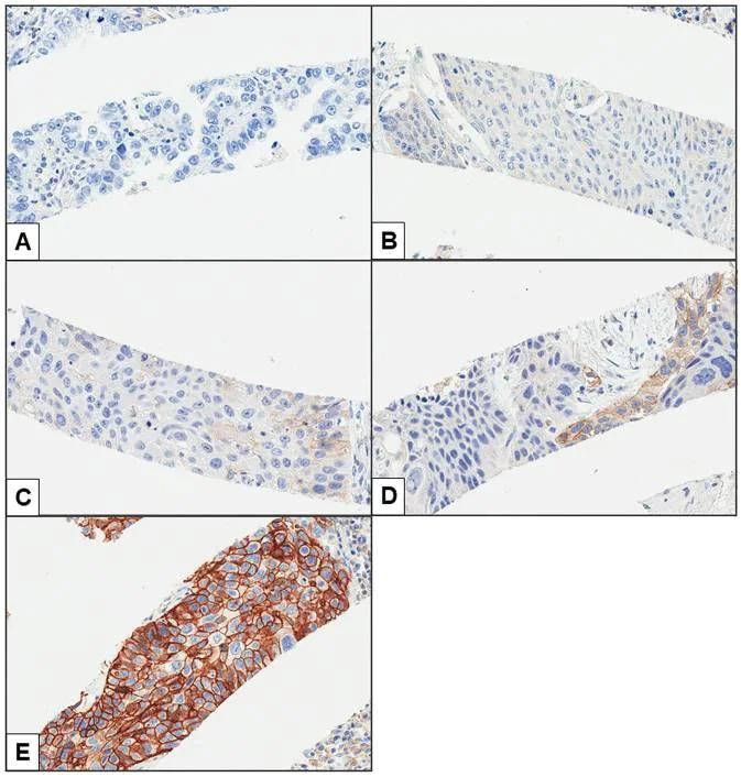 Immunohistochemistry (Formalin/PFA-fixed paraffin-embedded sections) - Anti-PD-L1 antibody [28-8] (AB205921)