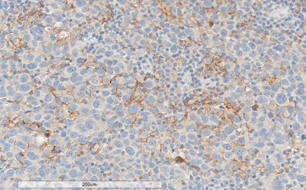 Immunohistochemistry (Formalin/PFA-fixed paraffin-embedded sections) - Anti-PD-L1 antibody [28-8] (AB205921)