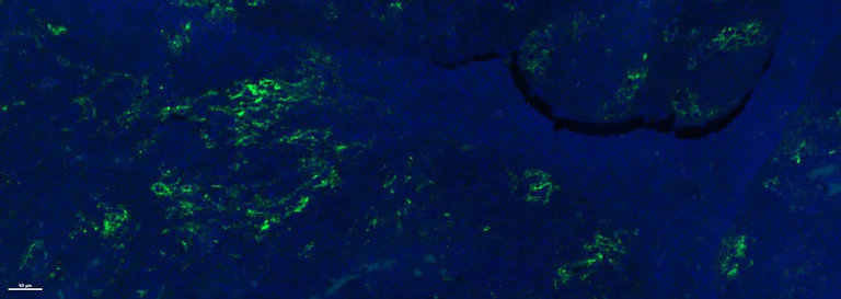Immunohistochemistry (Formalin/PFA-fixed paraffin-embedded sections) - Anti-PD-L1 antibody [28-8] (AB205921)