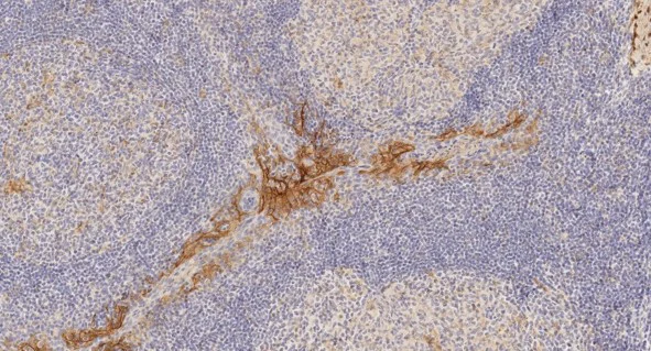 Immunohistochemistry (Formalin/PFA-fixed paraffin-embedded sections) - Anti-PD-L1 antibody [28-8] (AB205921)