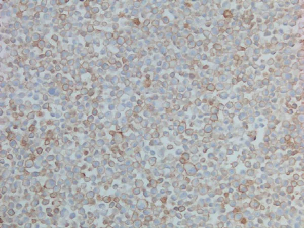 Immunohistochemistry (Formalin/PFA-fixed paraffin-embedded sections) - Anti-PD-L1 antibody [28-8] (AB205921)