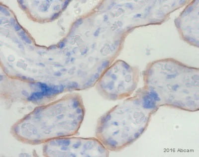 Immunohistochemistry (Formalin/PFA-fixed paraffin-embedded sections) - Anti-PD-L1 antibody [28-8] (AB205921)