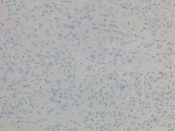 Immunohistochemistry (Formalin/PFA-fixed paraffin-embedded sections) - Anti-PD-L1 antibody [28-8] (AB205921)