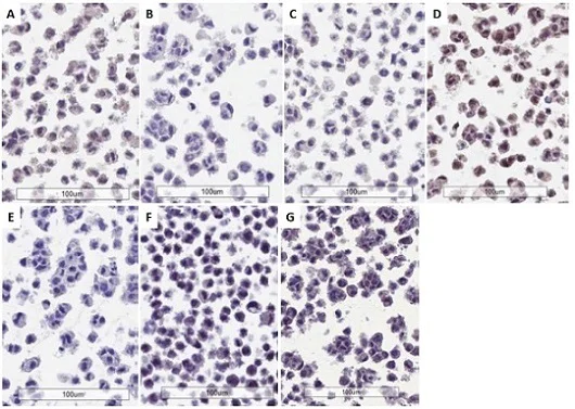Immunohistochemistry (Formalin/PFA-fixed paraffin-embedded sections) - Anti-PD-L1 antibody [28-8] (AB205921)