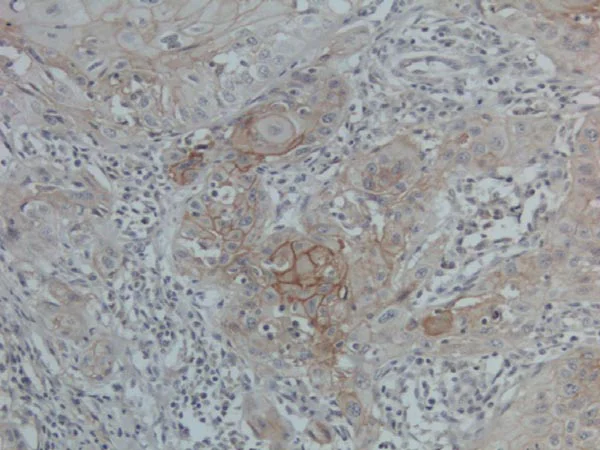 Immunohistochemistry (Formalin/PFA-fixed paraffin-embedded sections) - Anti-PD-L1 antibody [28-8] - BSA and Azide free (AB228413)