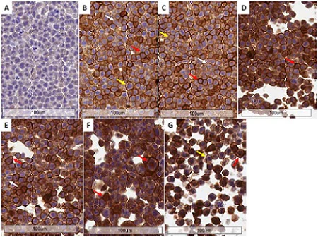 Immunohistochemistry (Formalin/PFA-fixed paraffin-embedded sections) - Anti-PD-L1 antibody [28-8] - BSA and Azide free (AB228413)