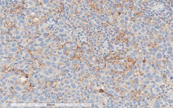 Immunohistochemistry (Formalin/PFA-fixed paraffin-embedded sections) - Anti-PD-L1 antibody [28-8] - Low endotoxin, Azide free (ab209889), expandable thumbnail