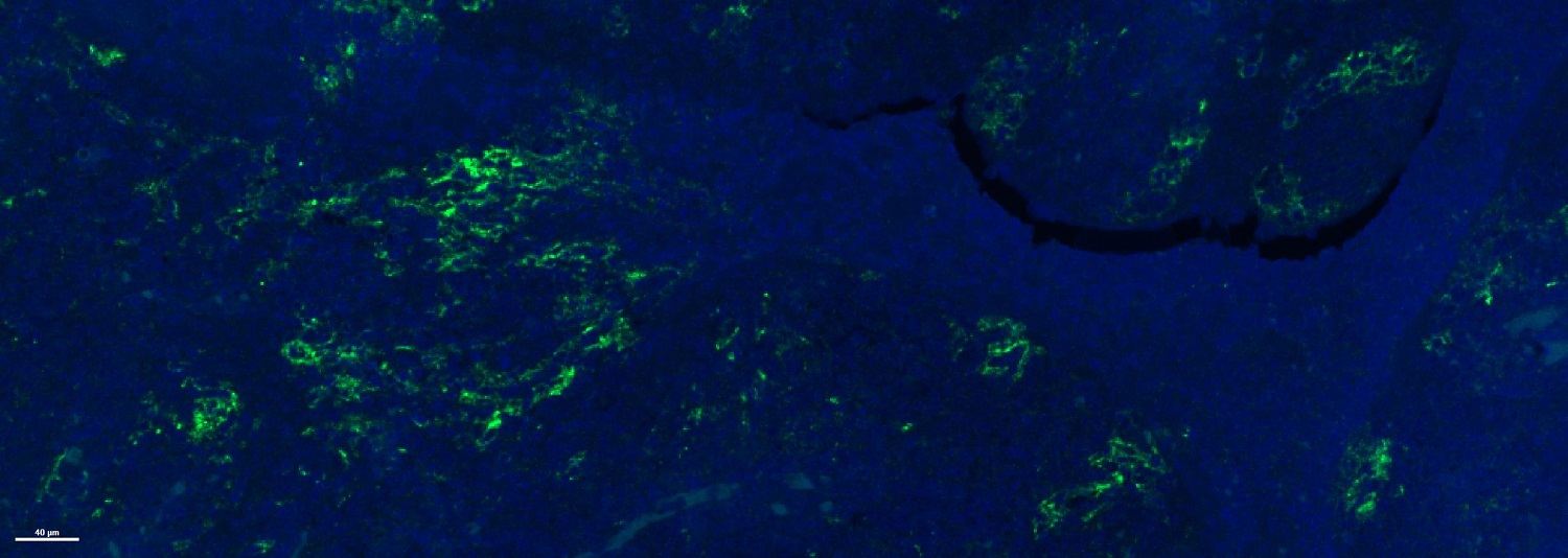 Immunohistochemistry (Formalin/PFA-fixed paraffin-embedded sections) - Anti-PD-L1 antibody [28-8] - Low endotoxin, Azide free (ab209889), expandable thumbnail