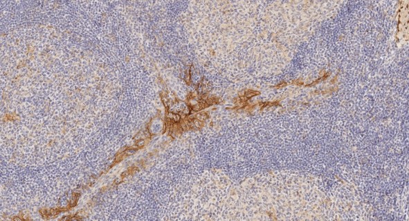 Immunohistochemistry (Formalin/PFA-fixed paraffin-embedded sections) - Anti-PD-L1 antibody [28-8] - Low endotoxin, Azide free (AB209889), expandable thumbnail