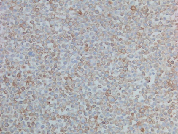 Immunohistochemistry (Formalin/PFA-fixed paraffin-embedded sections) - Anti-PD-L1 antibody [28-8] - Low endotoxin, Azide free (ab209889), expandable thumbnail