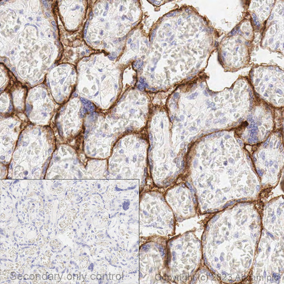 Immunohistochemistry (Formalin/PFA-fixed paraffin-embedded sections) - Anti-PD-L1 antibody [28-8] - Low endotoxin, Azide free (ab209889), expandable thumbnail
