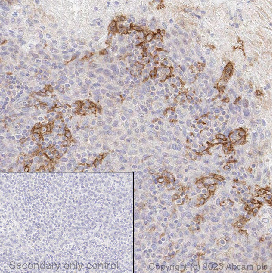 Immunohistochemistry (Formalin/PFA-fixed paraffin-embedded sections) - Anti-PD-L1 antibody [28-8] - Low endotoxin, Azide free (ab209889), expandable thumbnail