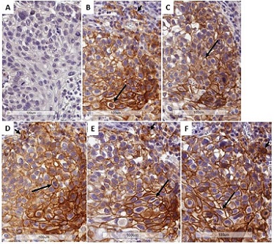 Immunohistochemistry (Formalin/PFA-fixed paraffin-embedded sections) - Anti-PD-L1 antibody [28-8] - Low endotoxin, Azide free (ab209889), expandable thumbnail
