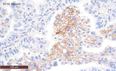Immunohistochemistry (Formalin/PFA-fixed paraffin-embedded sections) - Anti-PD-L1 antibody [28-8] - Low endotoxin, Azide free (ab209889), expandable thumbnail
