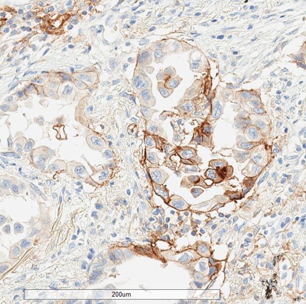 Immunohistochemistry (Formalin/PFA-fixed paraffin-embedded sections) - Anti-PD-L1 antibody [28-8] - Low endotoxin, Azide free (ab209889), expandable thumbnail