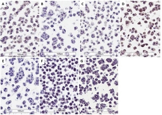 Immunohistochemistry (Formalin/PFA-fixed paraffin-embedded sections) - Anti-PD-L1 antibody [28-8] - Low endotoxin, Azide free (ab209889), expandable thumbnail