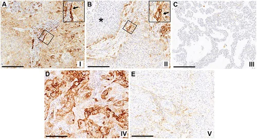 Immunohistochemistry (Formalin/PFA-fixed paraffin-embedded sections) - Anti-PD-L1 antibody [73-10] (AB228415)