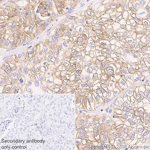 Immunohistochemistry (Formalin/PFA-fixed paraffin-embedded sections) - Anti-PD-L1 antibody [73-10] (AB228415)