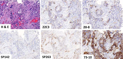 Immunohistochemistry (Formalin/PFA-fixed paraffin-embedded sections) - Anti-PD-L1 antibody [73-10] (AB228415)