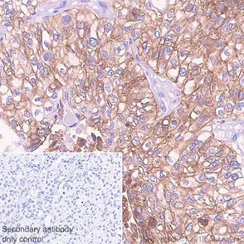 Immunohistochemistry (Formalin/PFA-fixed paraffin-embedded sections) - Anti-PD-L1 antibody [73-10] (AB228415)