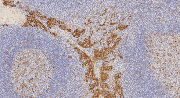Immunohistochemistry (Formalin/PFA-fixed paraffin-embedded sections) - Anti-PD-L1 antibody [73-10] (AB228415)