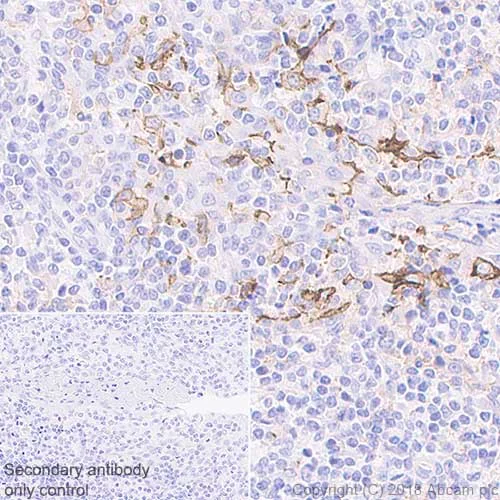 Immunohistochemistry (Formalin/PFA-fixed paraffin-embedded sections) - Anti-PD-L1 antibody [73-10] (AB228415)