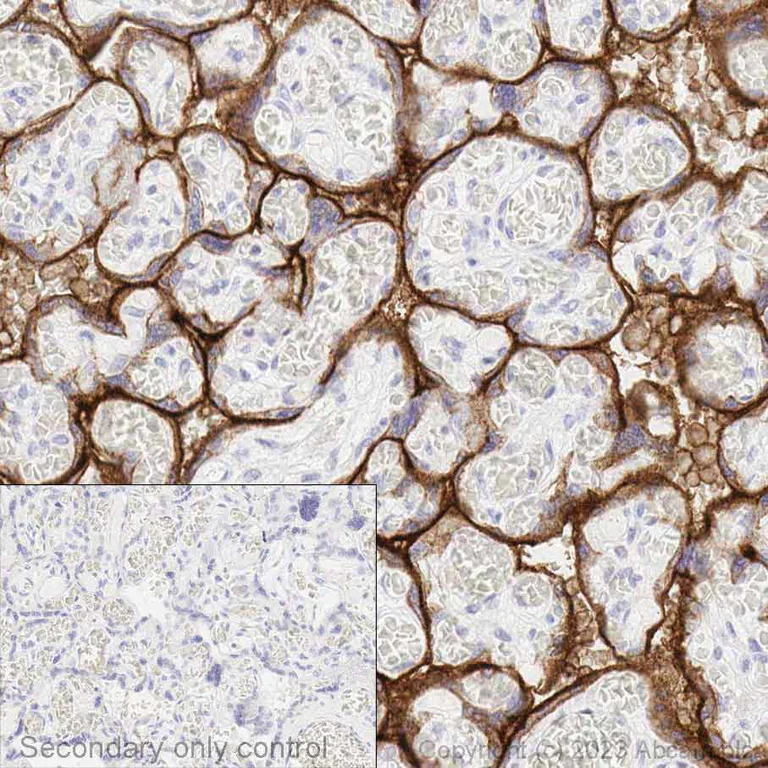 Immunohistochemistry (Formalin/PFA-fixed paraffin-embedded sections) - Anti-PD-L1 antibody [73-10] (AB228415)