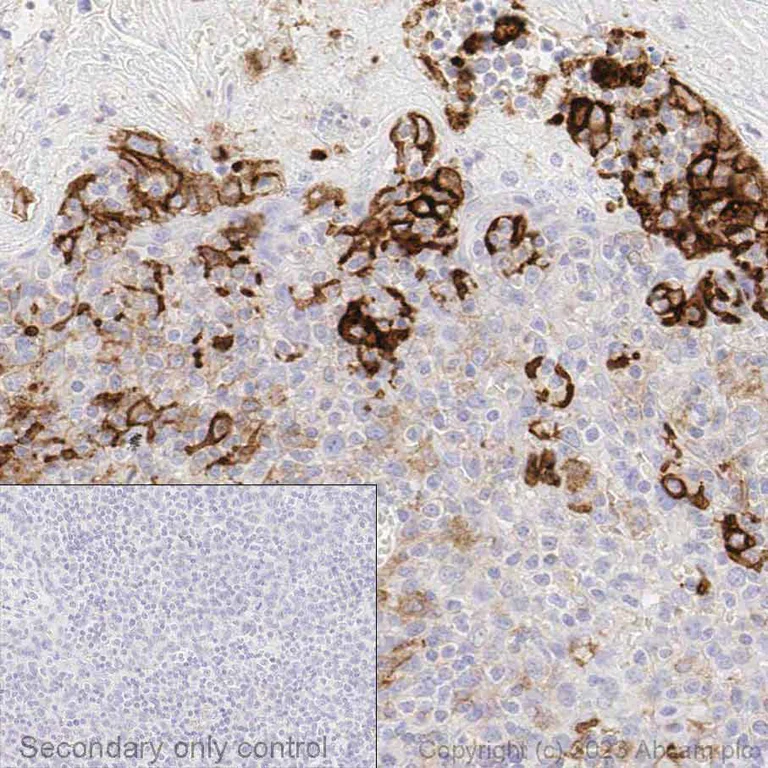 Immunohistochemistry (Formalin/PFA-fixed paraffin-embedded sections) - Anti-PD-L1 antibody [73-10] (AB228415)