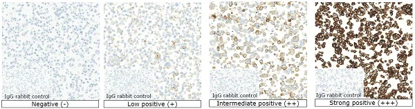 Immunohistochemistry (Formalin/PFA-fixed paraffin-embedded sections) - Anti-PD-L1 antibody [73-10] (AB228415)