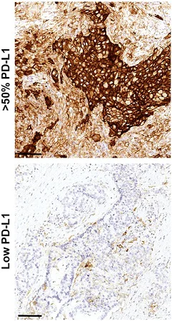 Immunohistochemistry (Formalin/PFA-fixed paraffin-embedded sections) - Anti-PD-L1 antibody [73-10] (AB228415)