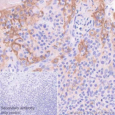 Immunohistochemistry (Formalin/PFA-fixed paraffin-embedded sections) - Anti-PD-L1 antibody [73-10] (AB228415)