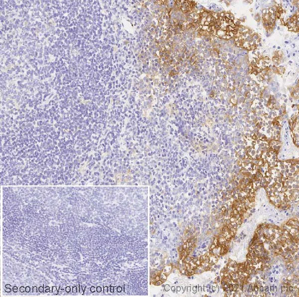 Immunohistochemistry (Frozen sections) - Anti-PD-L1 antibody [73-10] (AB228415)