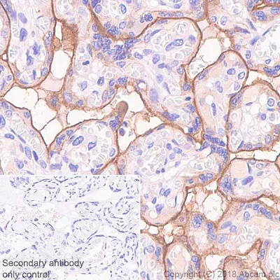 Immunohistochemistry (Formalin/PFA-fixed paraffin-embedded sections) - Anti-PD-L1 antibody [73-10] - BSA and Azide free (AB226766)