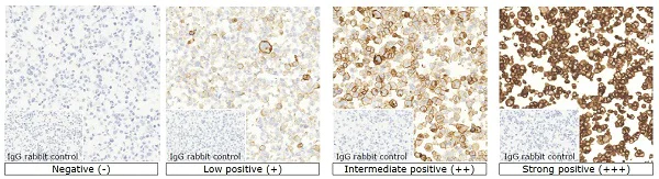 Immunohistochemistry (Formalin/PFA-fixed paraffin-embedded sections) - Anti-PD-L1 antibody [73-10] - BSA and Azide free (AB226766)