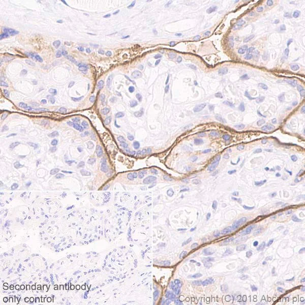 Immunohistochemistry (Formalin/PFA-fixed paraffin-embedded sections) - Anti-PD-L1 antibody [73-10] - Low endotoxin, Azide free (AB246698)